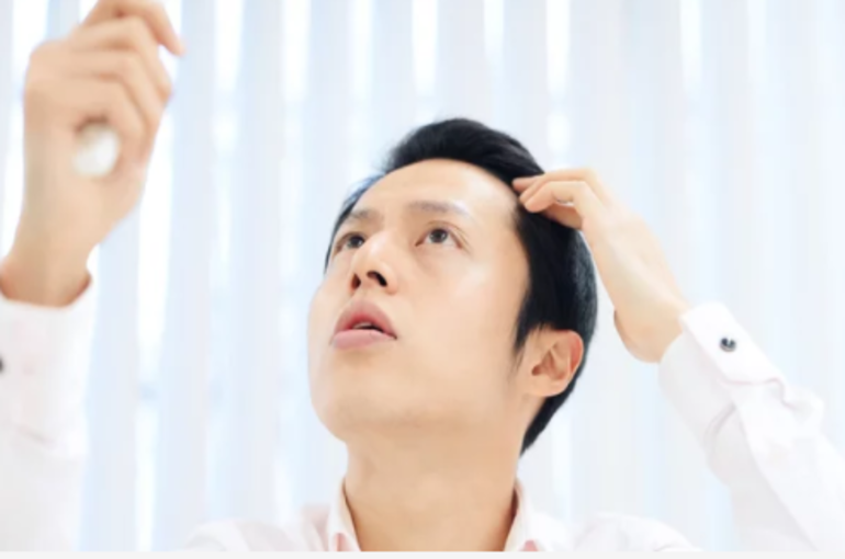 薄毛