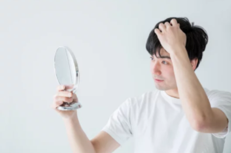 薄毛治療