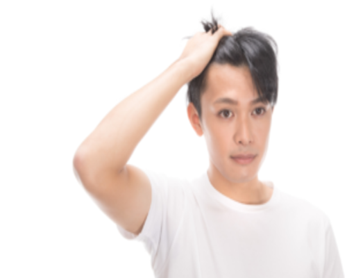 薄毛の原因